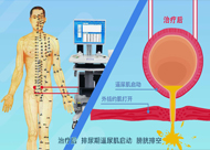 人和醫院 尿潴留、尿失禁動畫